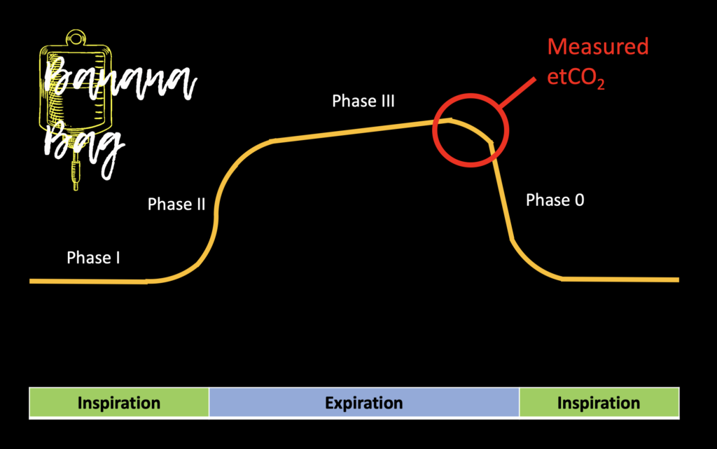 is-end-tidal-co2-the-real-6th-vital-sign